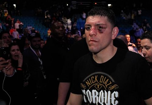 UFC 266 will mark the return of Nick Diaz