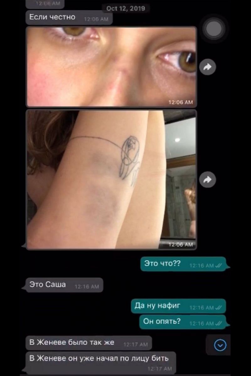 Sharypova&#039;s screenshot of her chat showing her bruises (Credits: Ben Rothenberg/Slate)