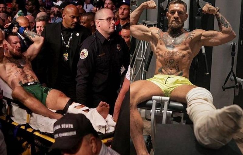 Conor McGregor suffered a gruesome leg injury during his UFC 264 fight against Dustin Poirier (*Images courtesy: Conor McGregor Instagram)