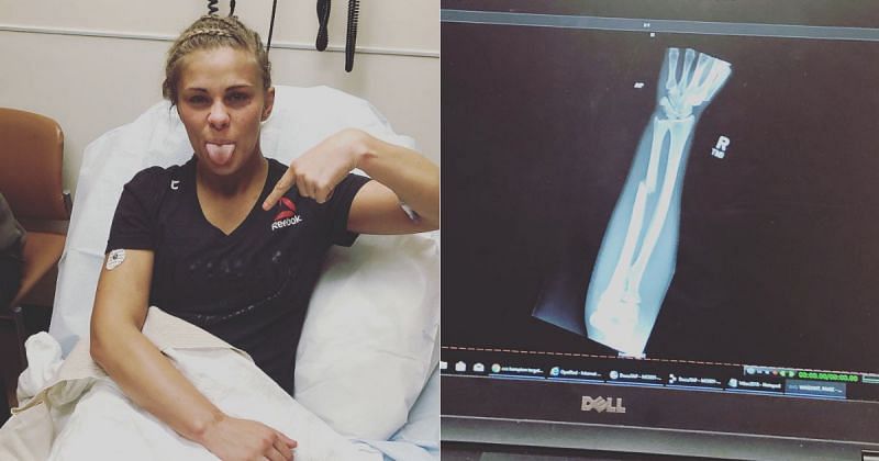 Paige VanZant suffered a broken arm in his fight against Jessica-Rose Clark at UFC Fight Night: Stephens vs Choi [Image credits: @paigevanzant on Instagram]