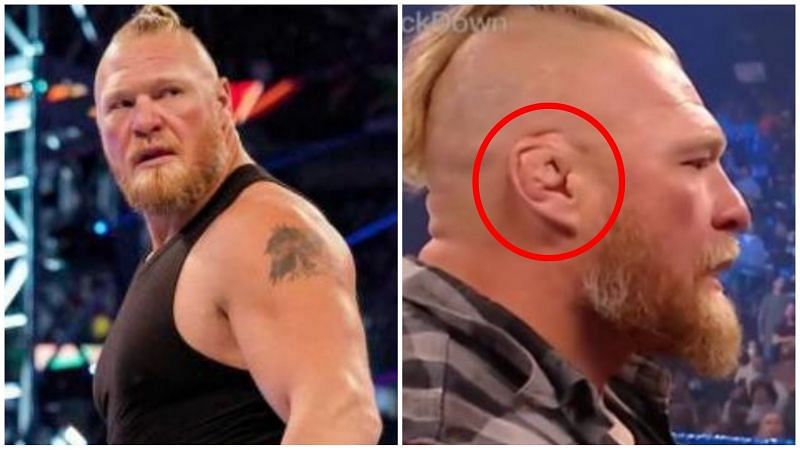 Brock Lesnar&#039;s right ear has always looked &#039;different&#039;