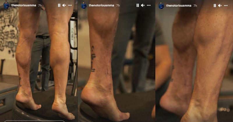 Conor McGregor displays the progress of his recovery [Image Credits- @thenotoriousmma on Instagram]