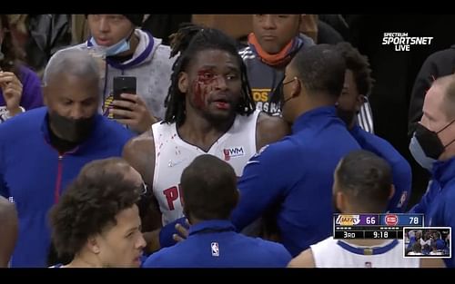 Isaiah Stewart of the Detroit Pistons was a bloody mess after taking a vicious hit from Los Angeles Lakers superstar LeBron James. [Photo: SB Nation]