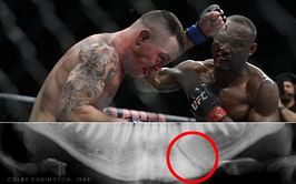 Photo: A look at Colby Covington's broken jaw X-ray