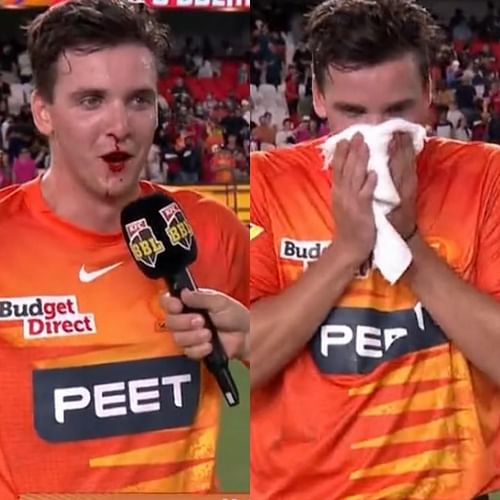 Jhye Richardson coped a nasty blow after BBL 2022 final. (Image source: Twitter)