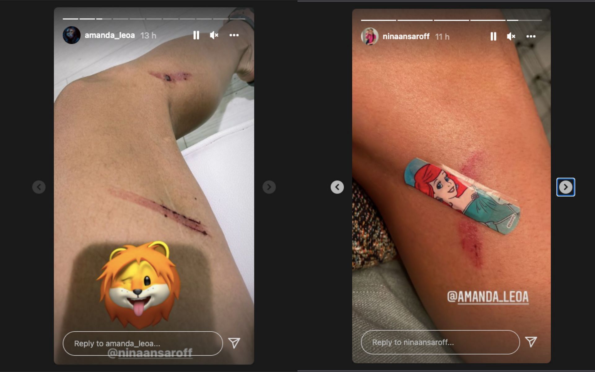 Amanda Nunes&#039; Instagram story (left) &amp; Nina Nunes&#039; Instagram story [Image Credits- @amanda_leoa and @ninaansaroff on Instagram]