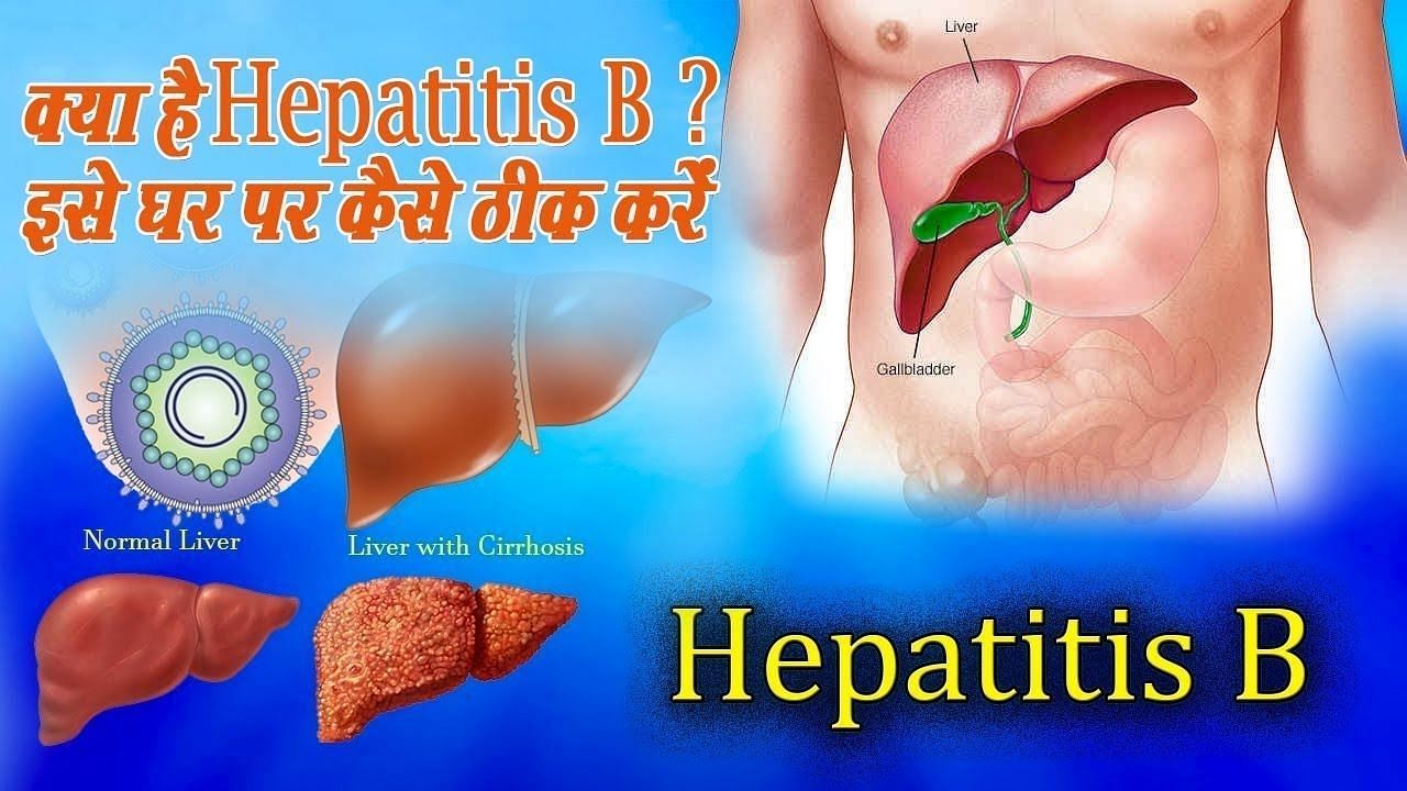 हेपेटाइटिस बी के घरेलू उपचार &ndash; Home remedies of Hepatitis B