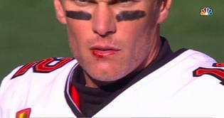 Watch: Bloodied Tom Brady draws 1st career unsportsmanlike conduct penalty for complaining