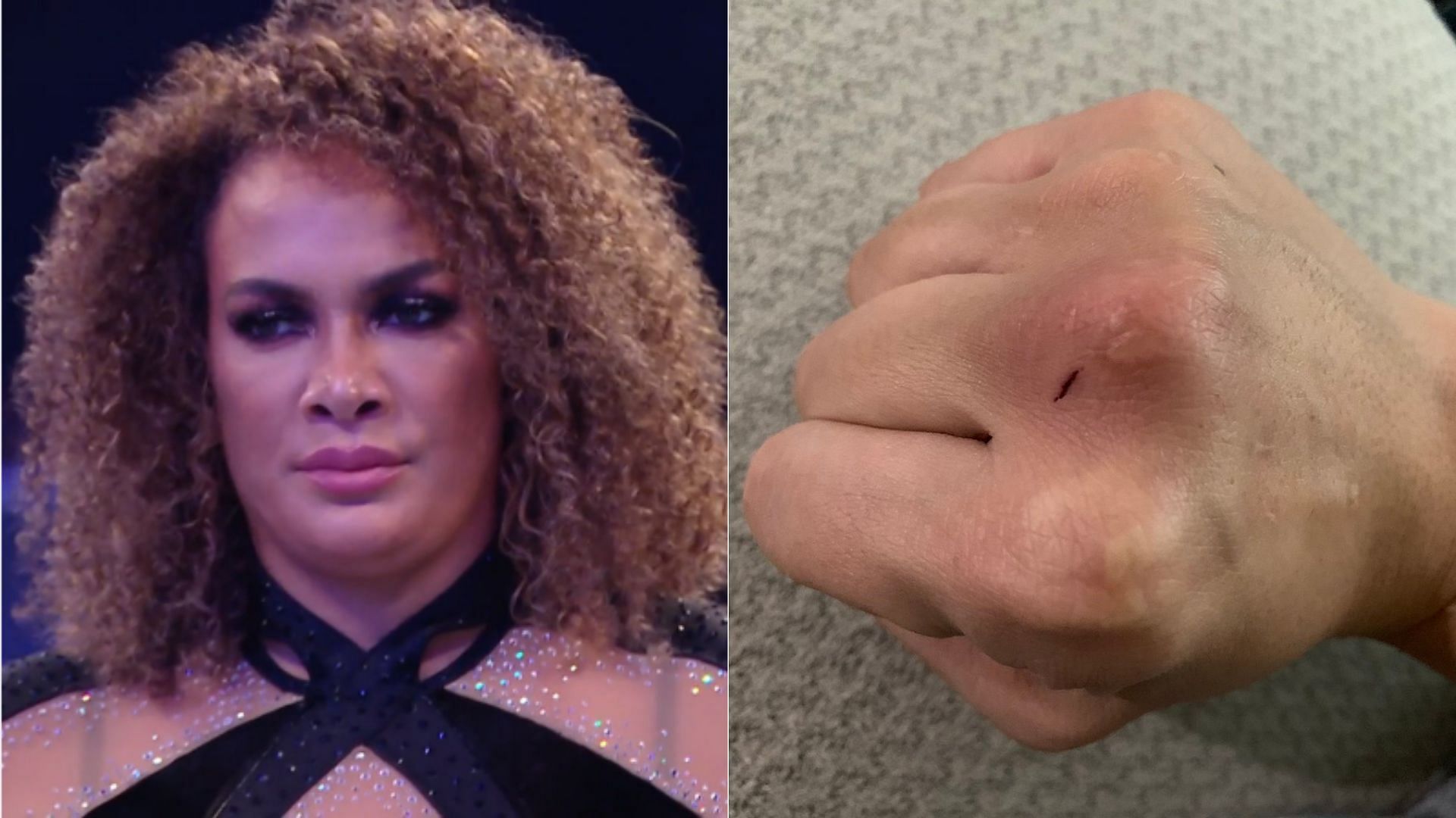 Nia Jax (left); Jax&#039;s fist after she punched Becky Lynch (right)