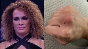 Nia Jax discloses the exact number of people she injured in WWE