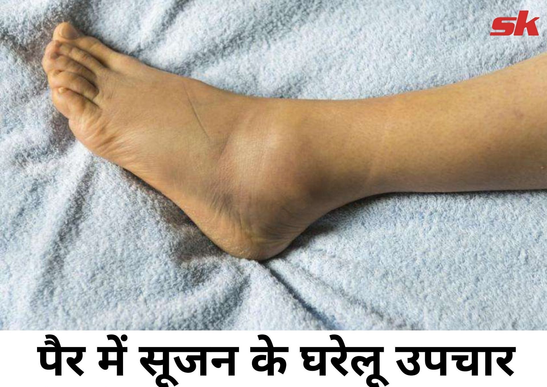 पैर में सूजन के घरेलू उपचार (फोटो - sportskeeda हिन्दी)