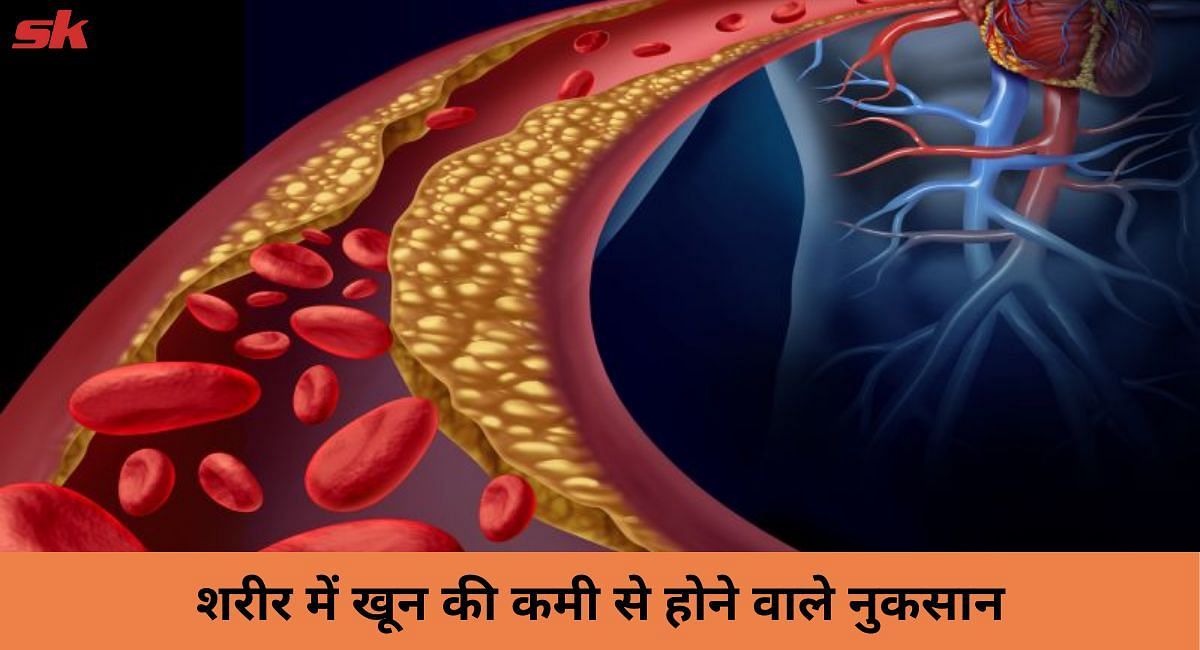 शरीर में खून की कमी से होने वाले नुकसान(फोटो-Sportskeeda hindi)