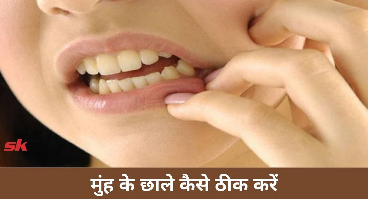 मुंह के छाले कैसे ठीक करें(फोटो-Sportskeeda hindi)