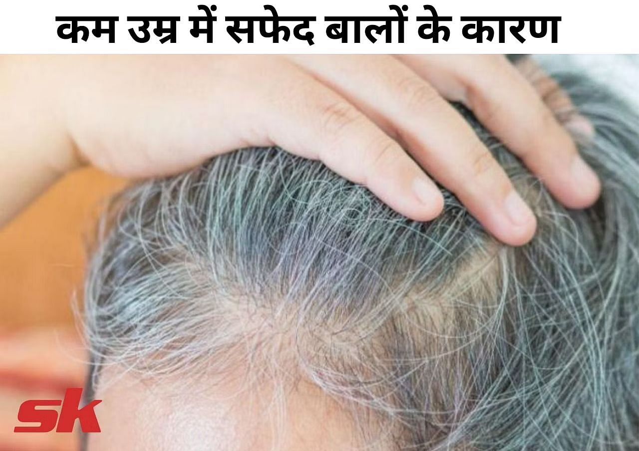 कम उम्र में सफेद बालों के कारण और बचाव (फोटो - sportskeeda hindi)