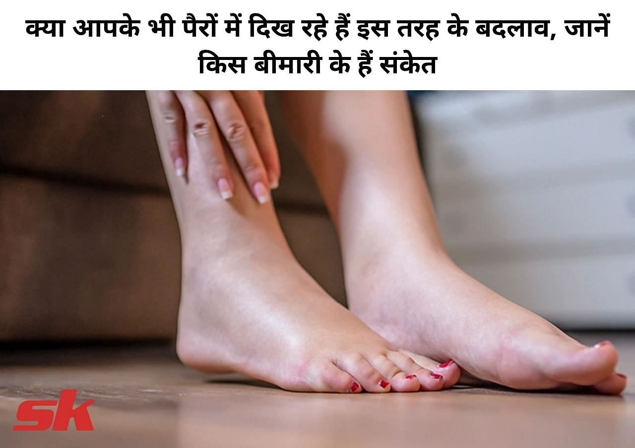 क्या आपके भी पैरों में दिख रहे हैं इस तरह के बदलाव, जानें किस बीमारी के हैं संकेत (फोटो - sportskeeda hindi)