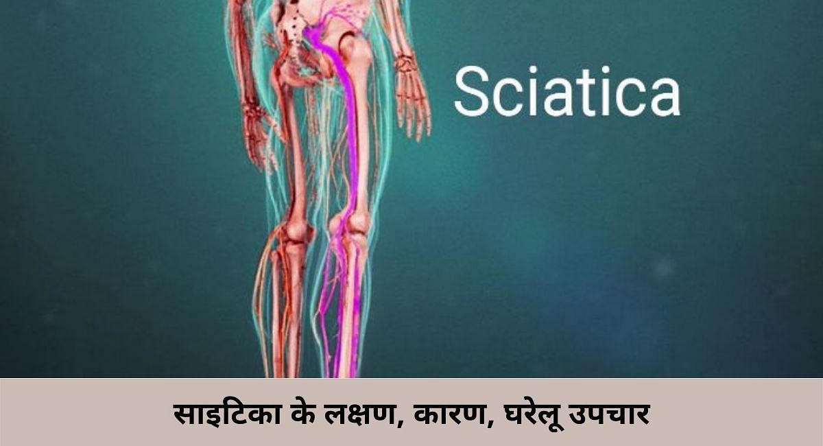 साइटिका के लक्षण, कारण और घरेलू उपचार(फोटो-Sportskeeda hindi)