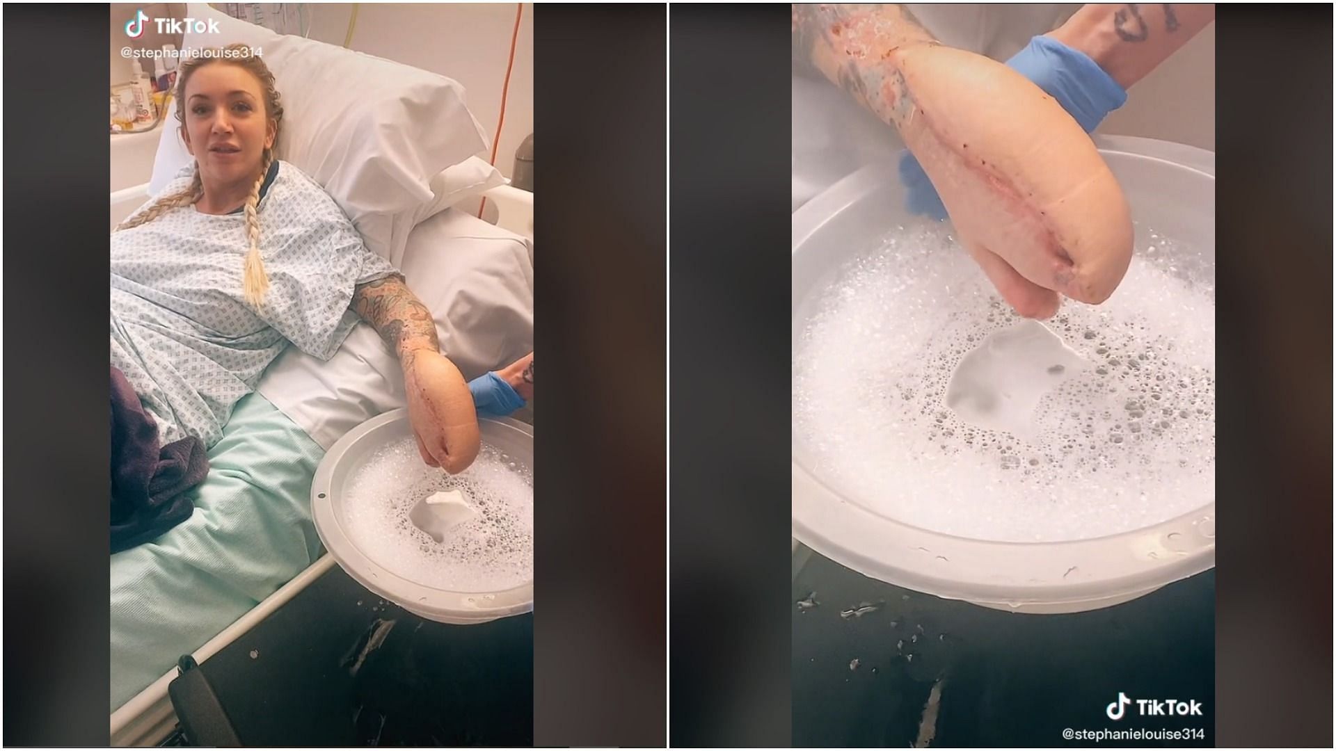 Video of Sadie Kemp showing her hand went viral on TikTok (Image via @sadiessepsisjourney/TikTok)