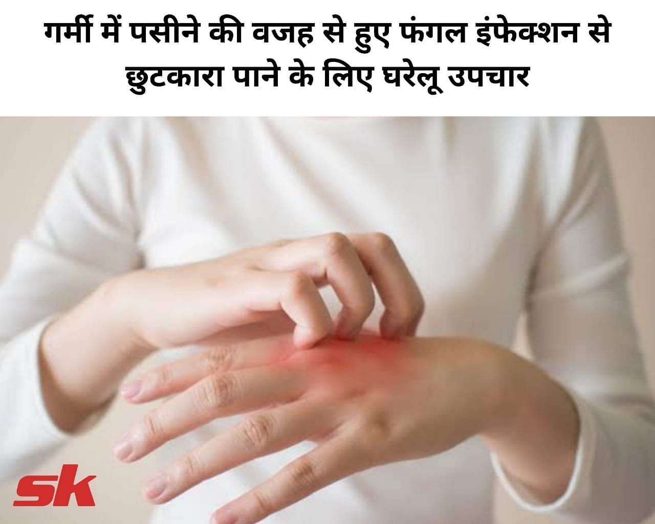 गर्मी में पसीने की वजह से हुए फंगल इंफेक्शन से छुटकारा पाने के लिए घरेलू उपचार (फोटो - sportskeeda hindi)
