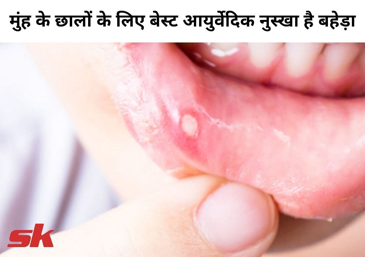 मुंह के छालों के लिए बेस्ट आयुर्वेदिक नुस्खा है बहेड़ा (फोटो - sportskeeda hindi)