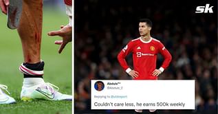“Couldn’t care less, he earns 500k weekly” – Manchester United fans show no sympathy towards Cristiano Ronaldo as picture of bruised leg surfaces