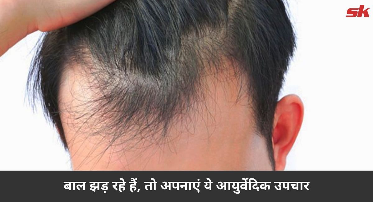 बाल झड़ रहे हैंं, तो अपनाएं ये आयुर्वेदिक उपचार (फोटो-Sportskeeda hindi)