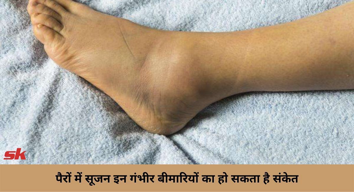 पैरों में सूजन इन गंभीर बीमारियों का हो सकता है संकेत (फोटो-Sportskeeda hindi)