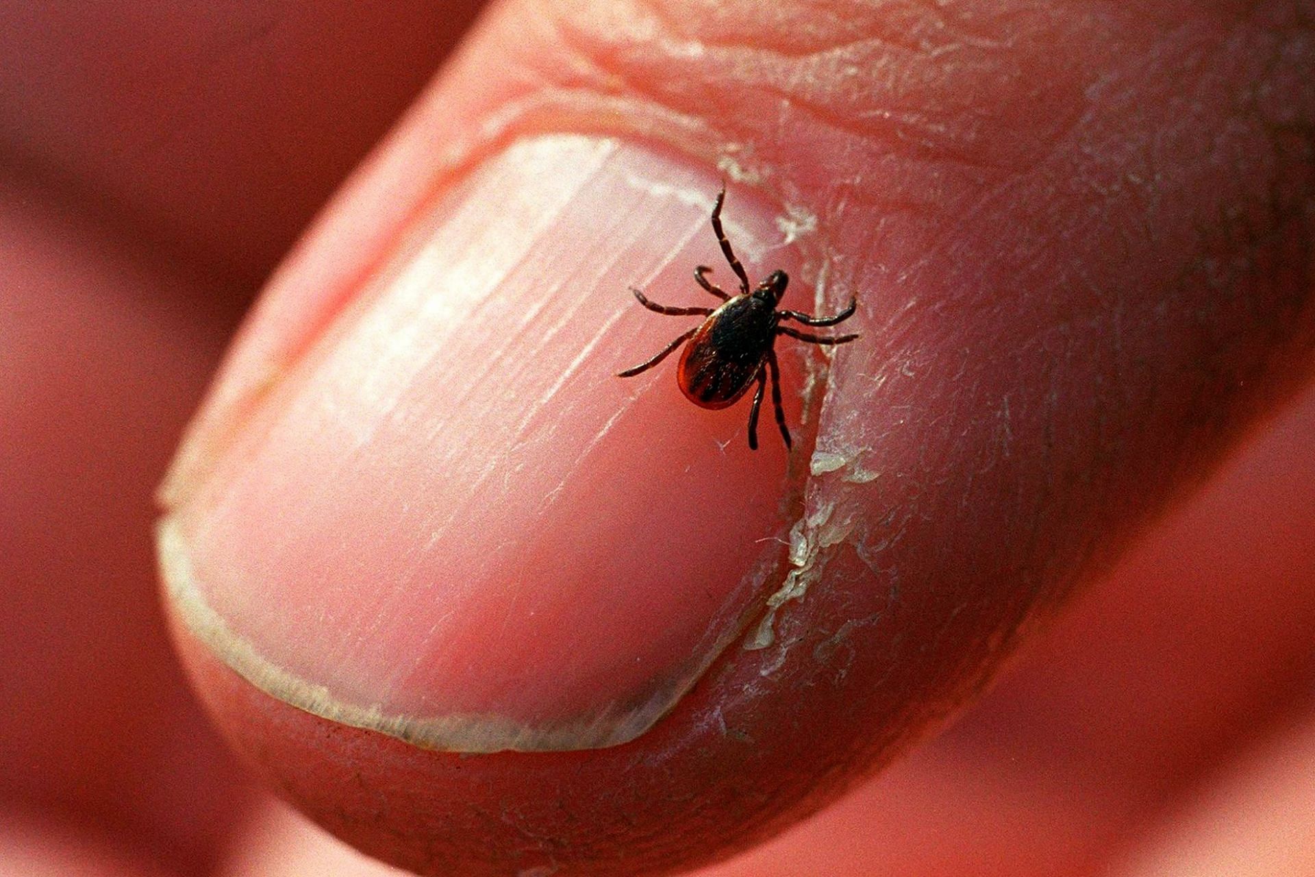 Ticks can cause a variety of virus infections (Image via Newsday LLC/Getty Images)