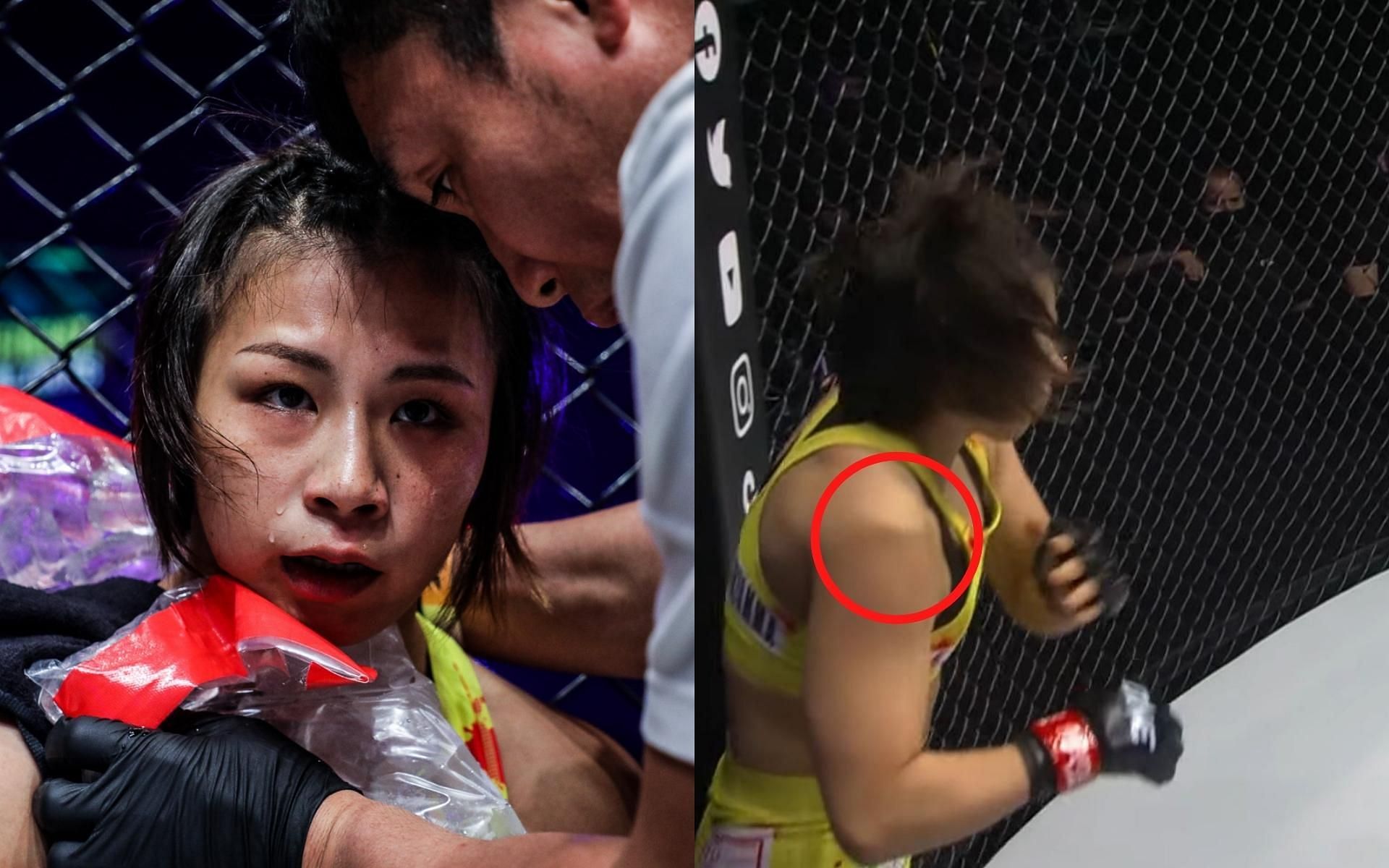 ONE Championship strawweight Ayaka Miura suffered a nasty shoulder injury at ONE 156. (Images courtesy of ONE Championship)