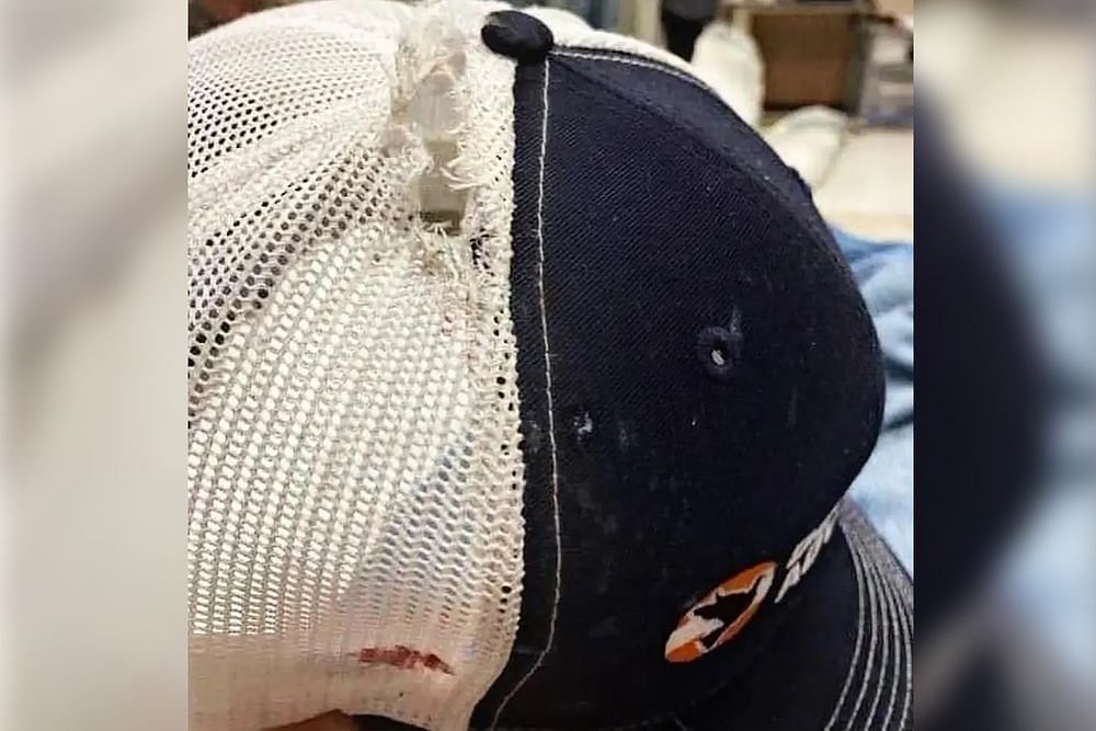 The BORTAC agent&#039;s cap ripped apart, leaving a gruesome injury on his scalp (Image via Customs and Border Patrol)