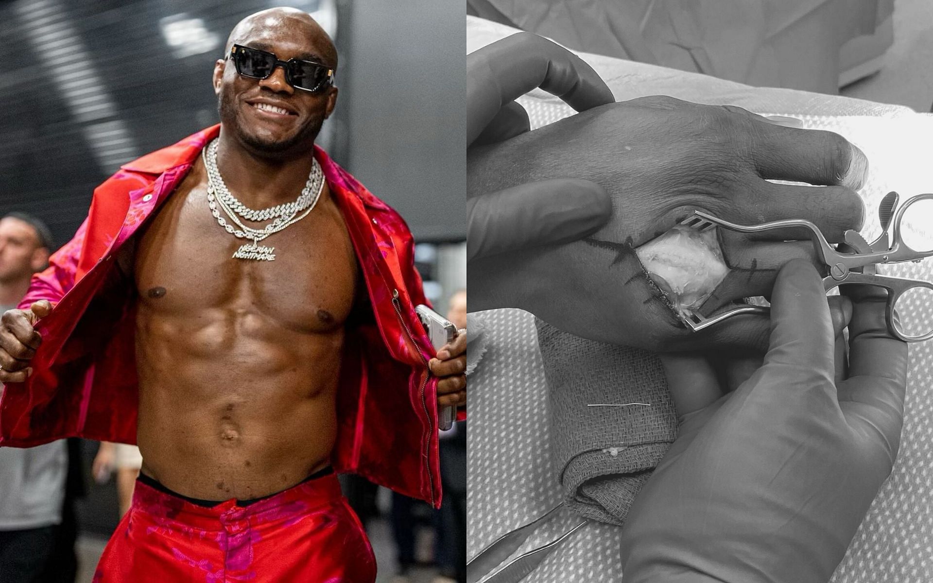 Kamaru Usman (L) [via @usman84kg on Instagram], Usman&#039;s operated hand (R) [via @danawhite on Twitter]