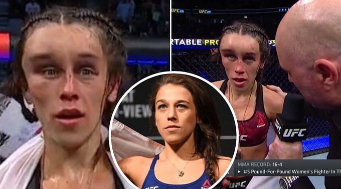 Joanna Jędrzejczyk S Forehead Before And After Injury At Ufc 248