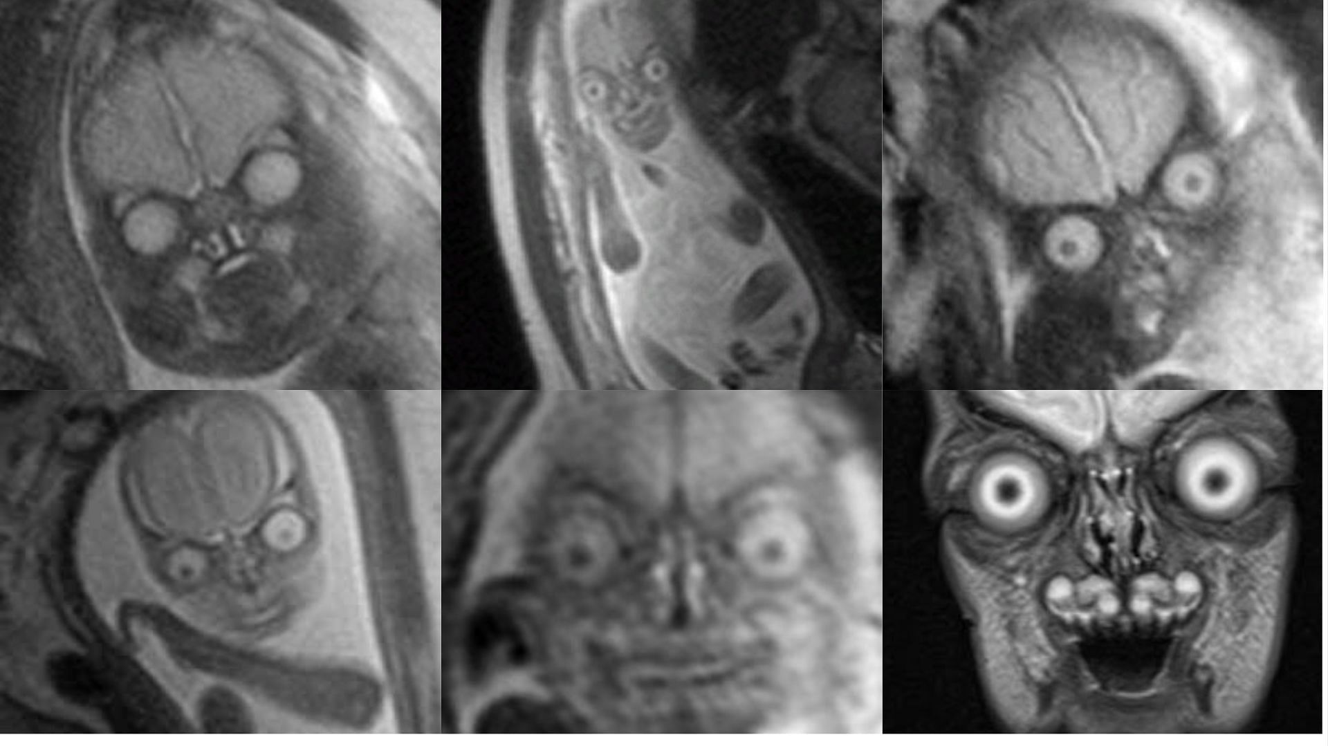 MRI scans of fetuses depict an unexpectedly creepy &#039;demonic&#039; appearance (Images via Twitter/ZiziFothSi)