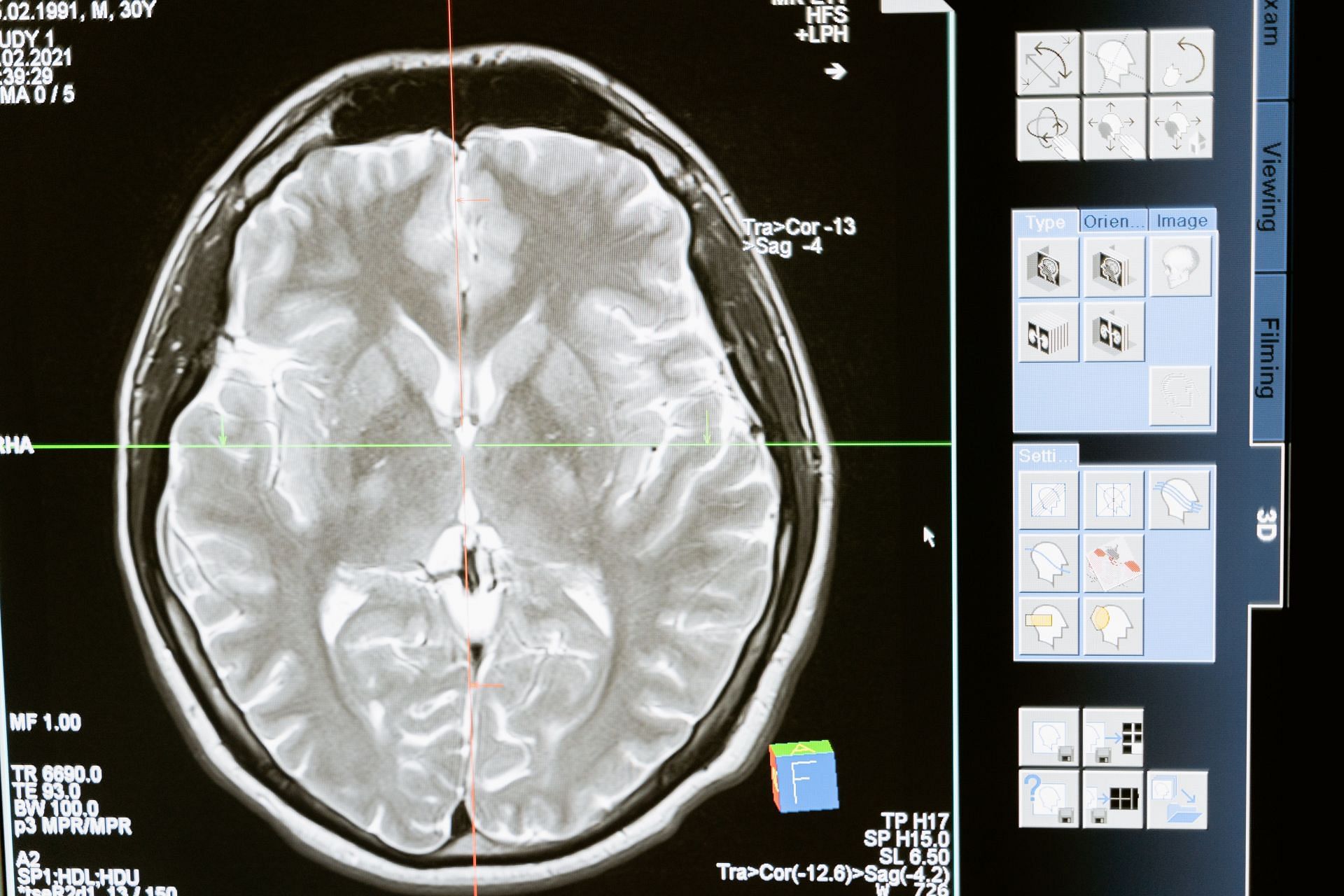 Ashwaghandha can help improve memory for schizophrenia patients. (Image via Pexels / Mart Production)