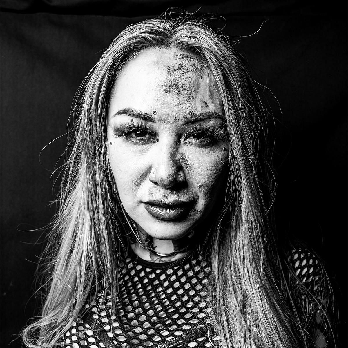 Shotzi Blackheart showing off her injury after the match!