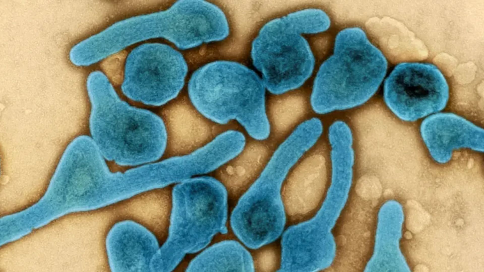 The Marburg virus outbreak in Ghana (Image via Universal Images Group/Getty Images)