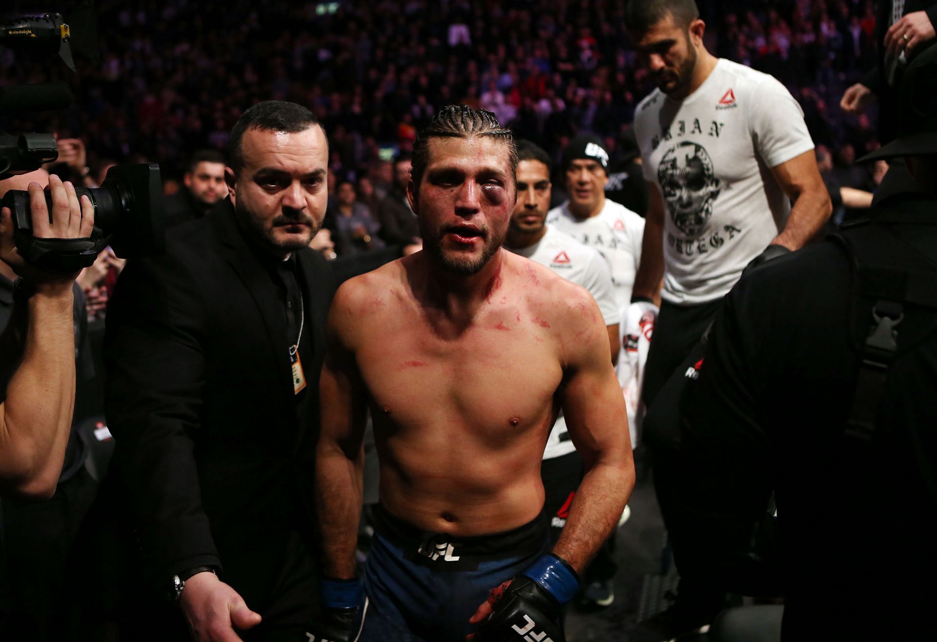 Brian Ortega after losing at UFC 231 [Images via Getty]