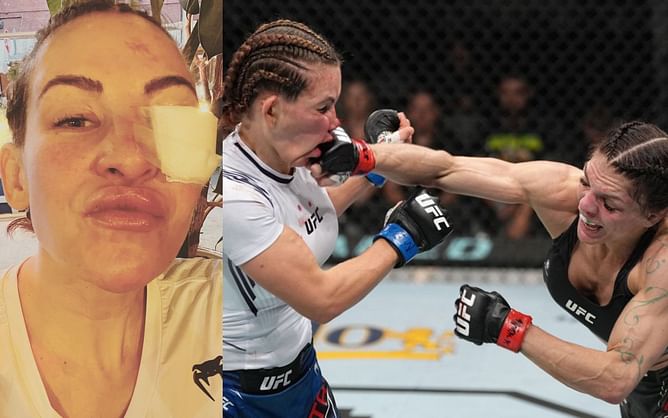 "Some women pay a lot for lips like this" - Classy Miesha Tate's spirits not broken after tough loss at UFC Long Island
