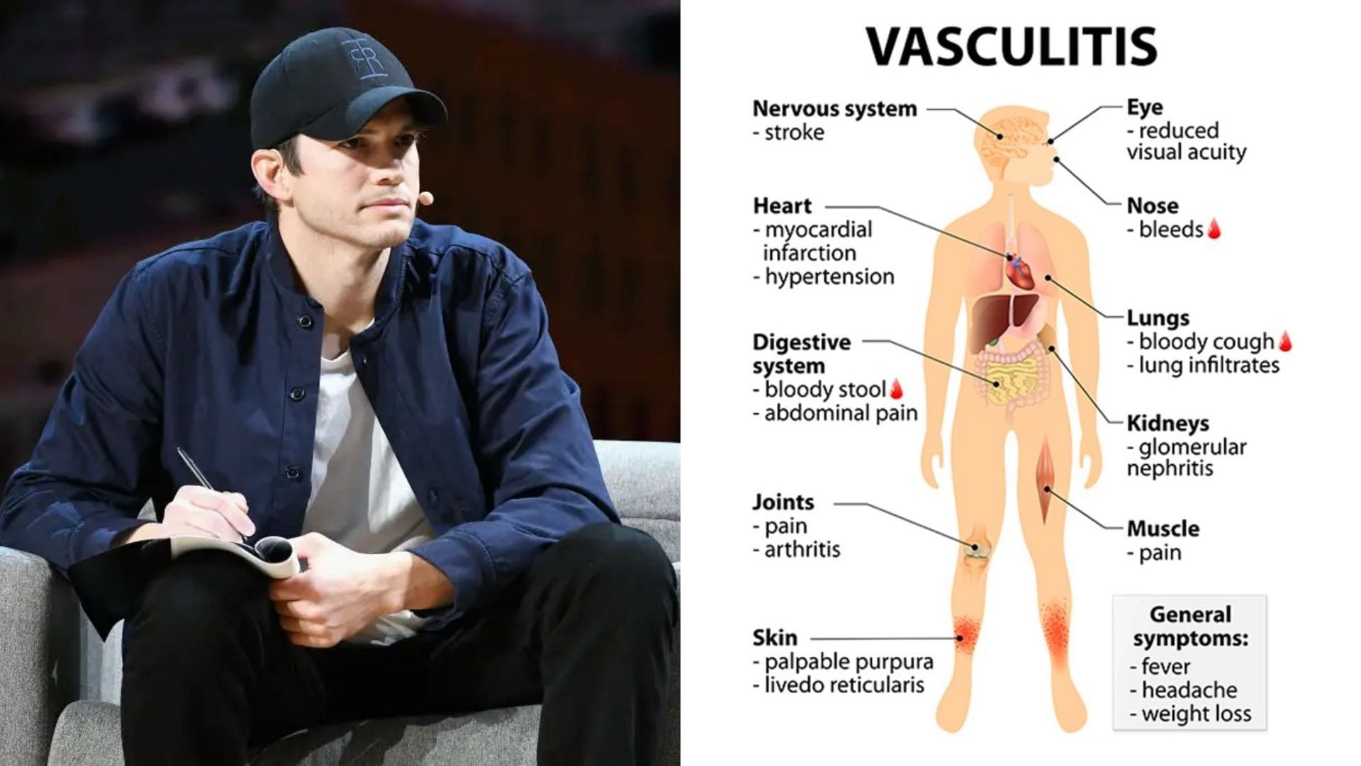 Ashton Kutcher has revealed that he suffered from vasculitis a couple of years ago (Image via Michael Kovac/Getty Images, and ttsz/iStock/Getty Images)