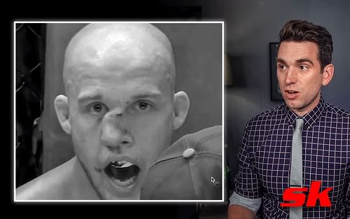 Blake Perry suffered a broken nose in his recent fight [Right image via Brian Sutterer MD on YouTube]