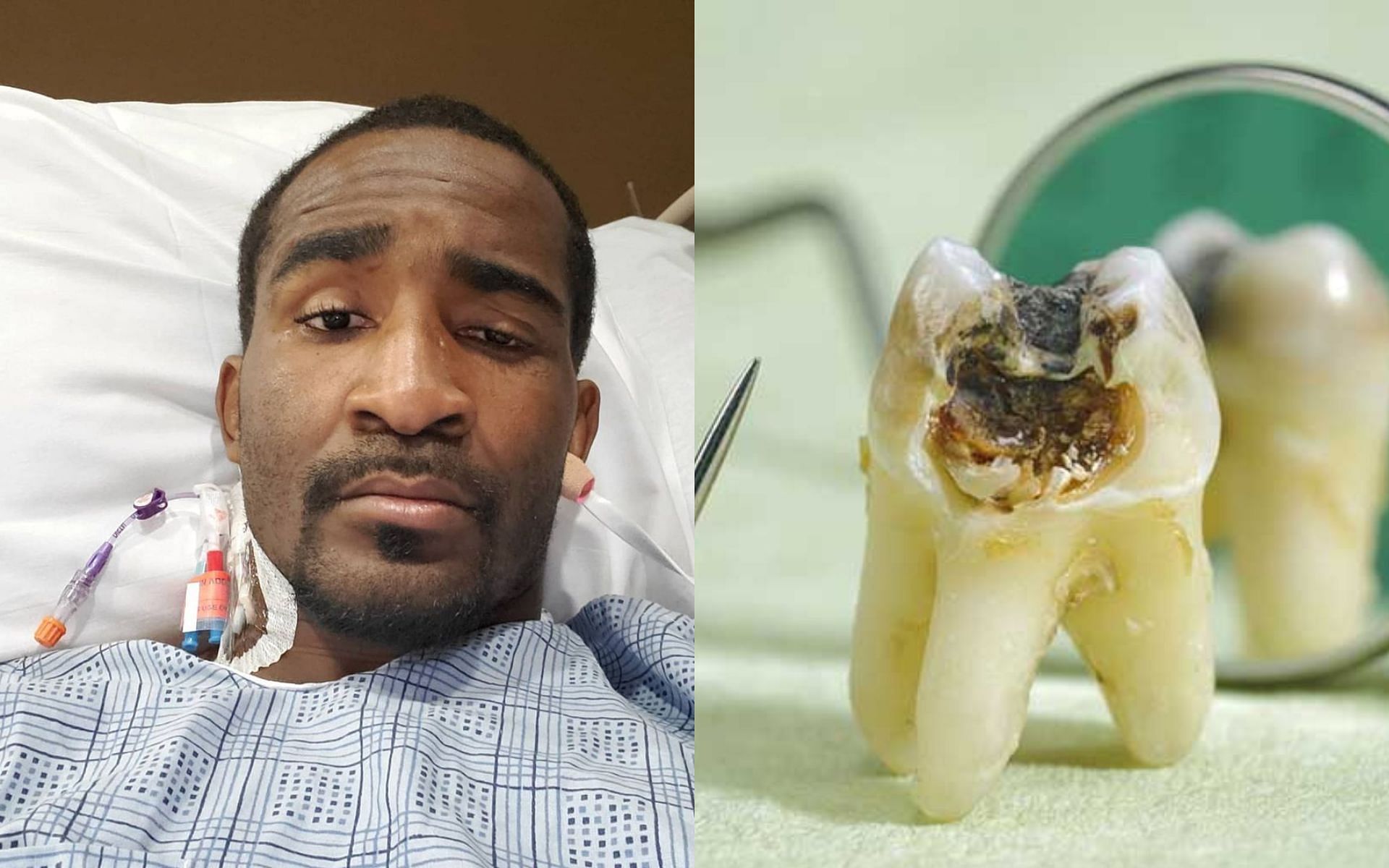 Geoff Neal (L) (via @handzofsteelmma on Instagram), Bad tooth (R) (via @thompsoncreekdental.com)