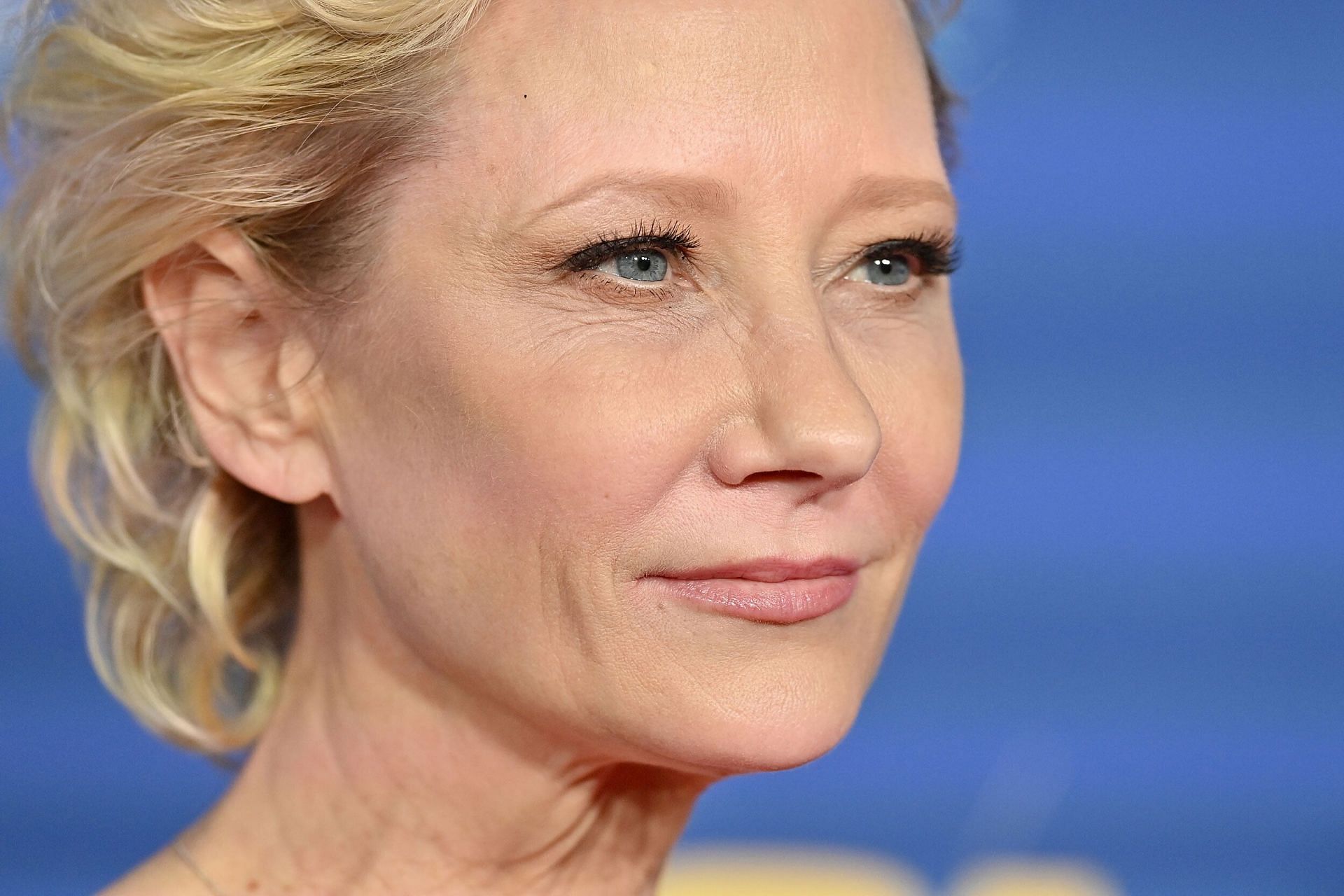 Anne Heche hospitalized after accident (Image via Axelle/Bauer-Griffin/FilmMagic/Getty Images)