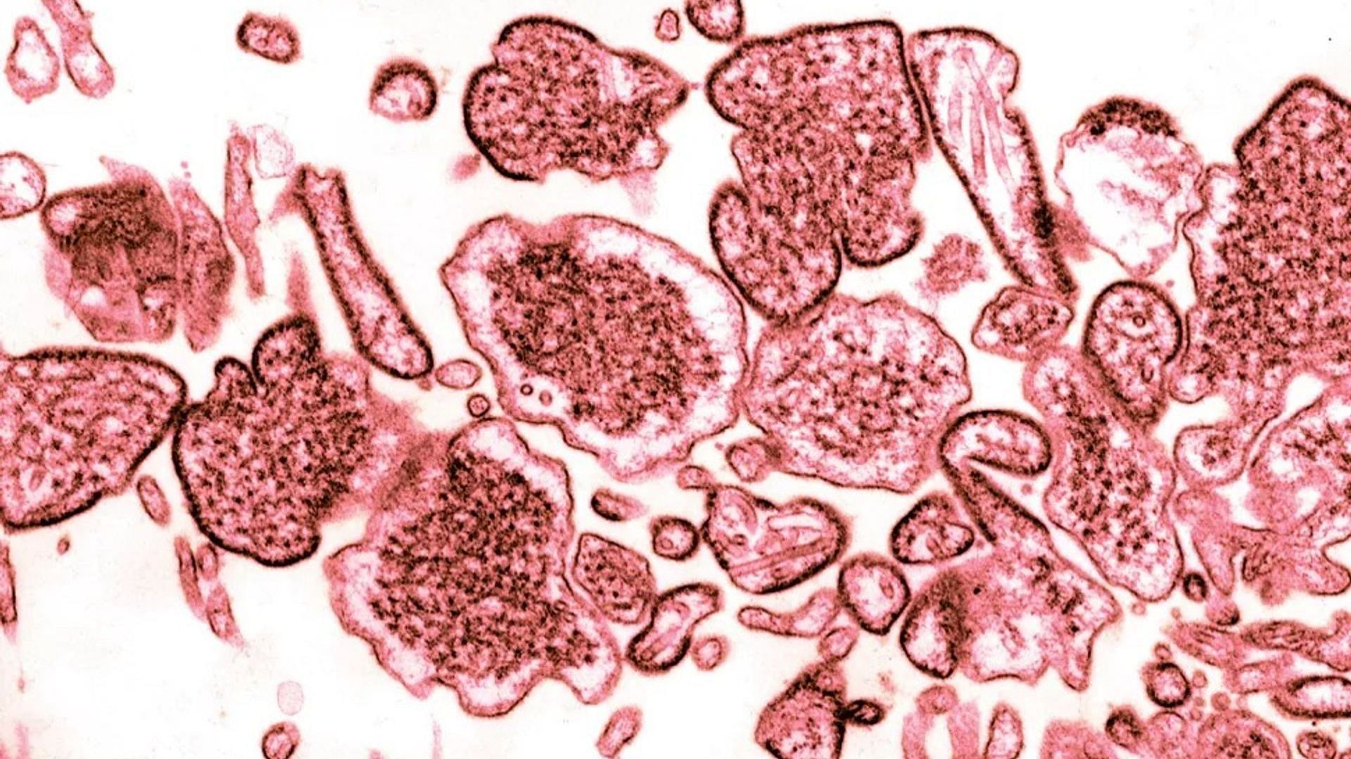 Sample of Nipah virus, which is from the same family as that of Langya virus (Image via BSIP/UIG/Getty Images)