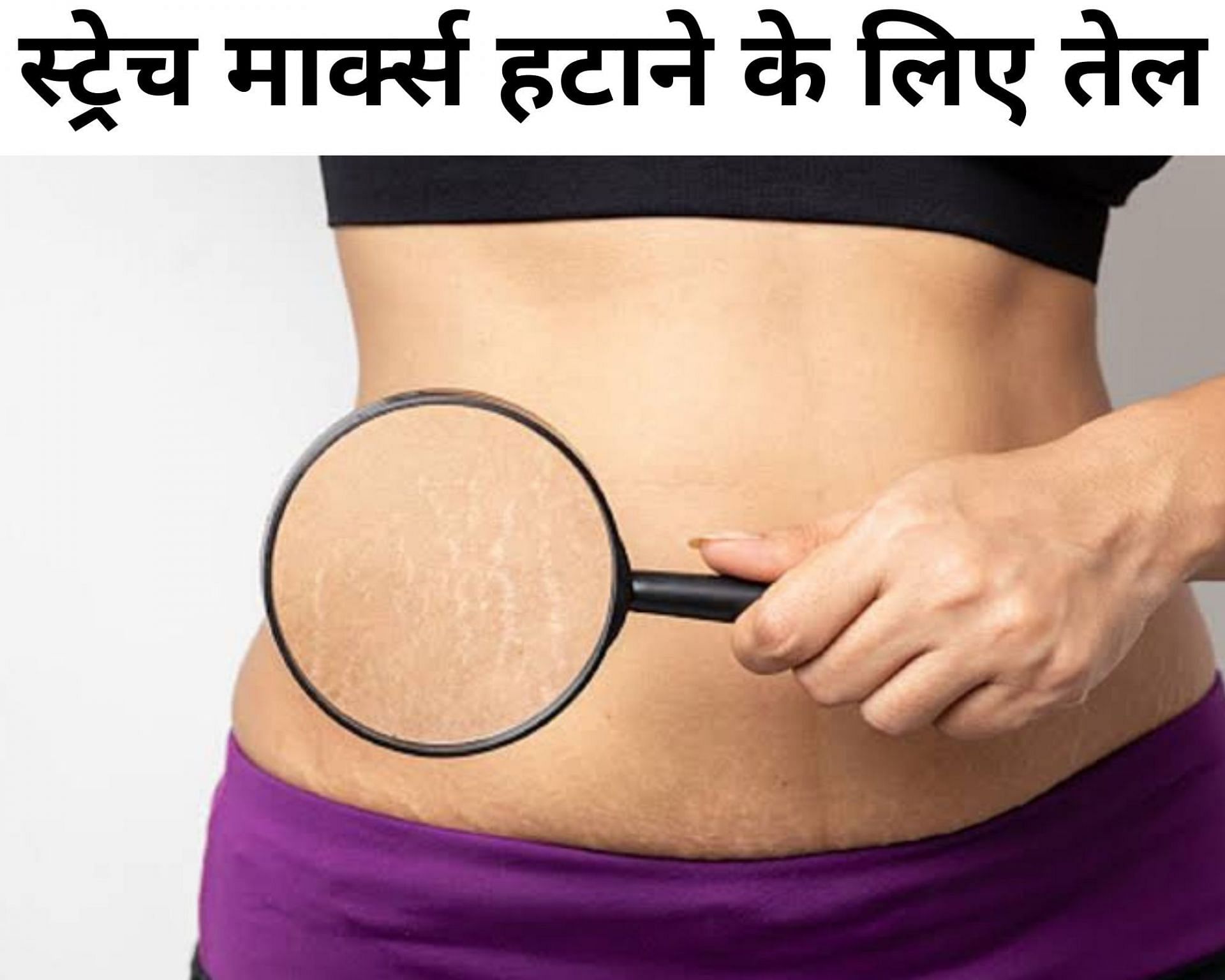 स्ट्रेच मार्क्स हटाने के लिए तेल (फोटो - sportskeeda hindi)