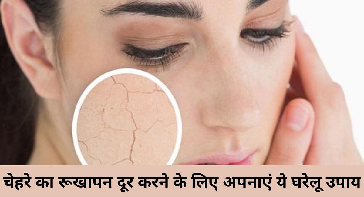 चेहरे का रूखापन दूर करने के लिए अपनाएं ये घरेलू उपाय(फोटो-Sportskeeda hindi)