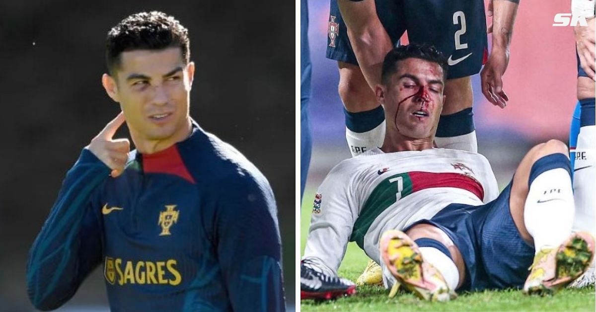 Ronaldo nurses injury from win over the Czechs