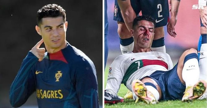 Cristiano Ronaldo pictured training with black eye and cut to the face after being bloodied by injury during Portugal’s win over Czech Republic