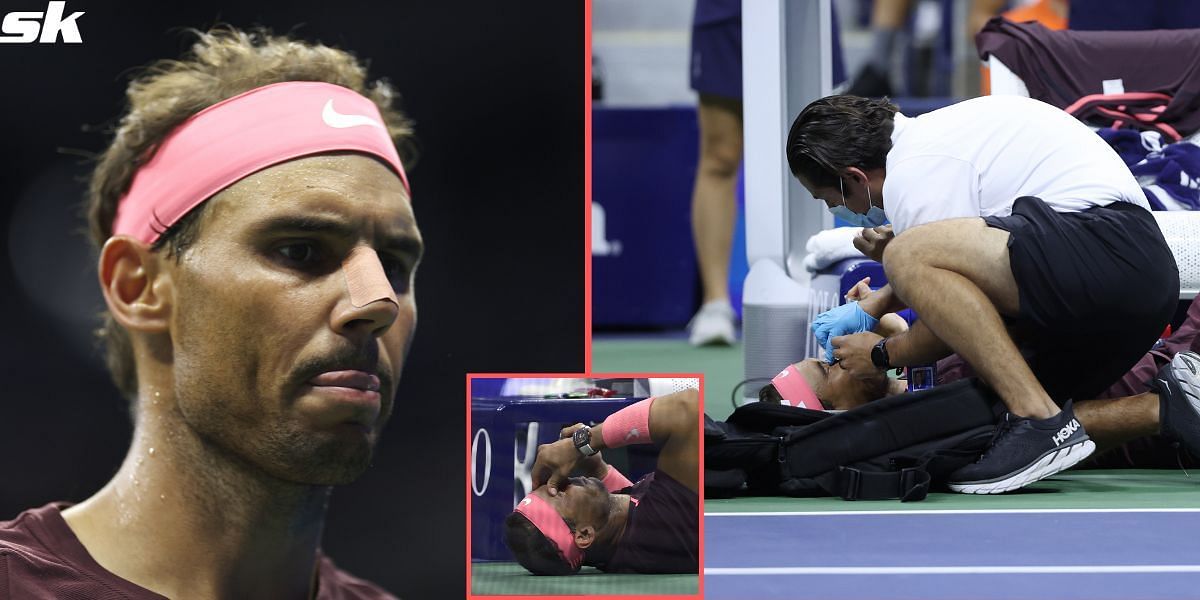 Rafael Nadal sustained a nose bleed during his 2R clash at the 2022 US Open against Fabio Fognini
