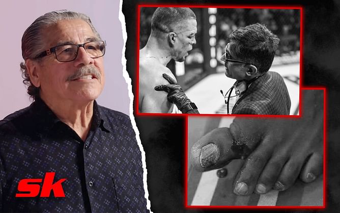 "I kind of pulled it, and then I taped it" - Veteran cutman Jacob 'Stitch' Duran revisits Jon Jones' broken toe, Nate Diaz's doctor's stoppage against Jorge Masvidal, and other UFC injuries
