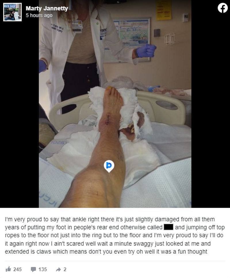 Marty Jannetty posted a picture of his injury on Facebook