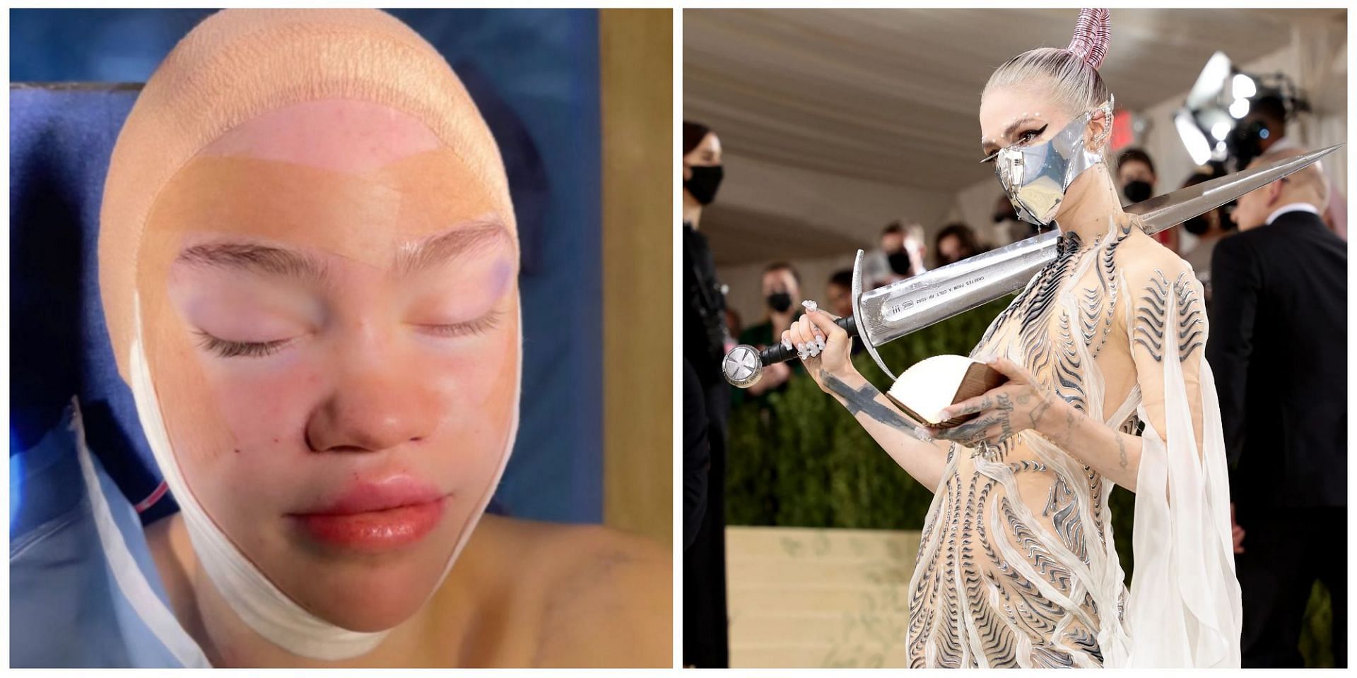 Did Grimes get an &quot;elf ear&quot; surgery? Netizens troll the musician after she posted a picture of herself with bandages on Twitter. (Image via Twitter)